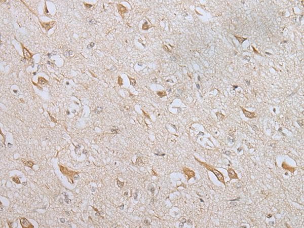 ZNF281 / Zfp281 Antibody
