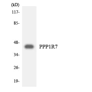 Polyclonal Rabbit anti-Human PPP1R7 Antibody (aa119-168, WB)