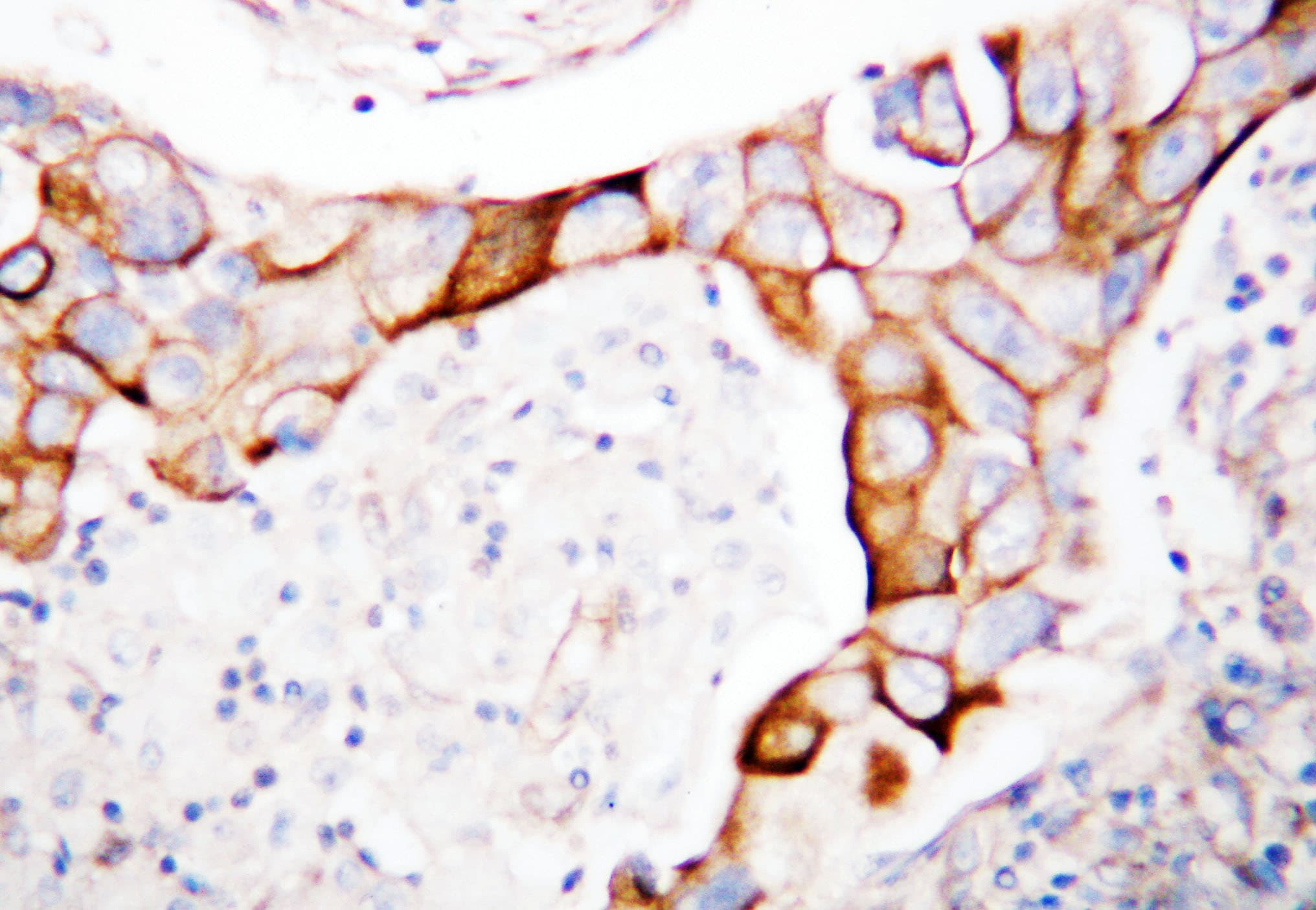 ITGB2 / CD18 Antibody (aa732-748)