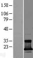 CMTM7 / CKLFSF7 Protein (Over-Expression Lysate Myc-DDK (Flag))