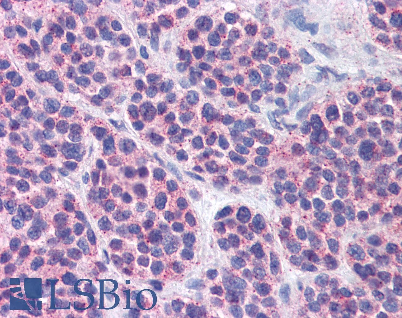 IHC-plus™ FKSG89 / MBOAT4 Antibody (Internal)