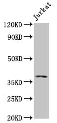Polyclonal Rabbit anti-Human MOS Antibody (IHC, WB)