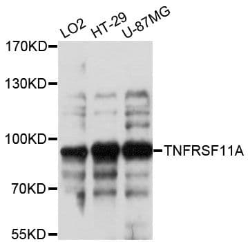 Polyclonal Rabbit anti-Human TNFRSF11A / RANK Antibody (IHC, WB)