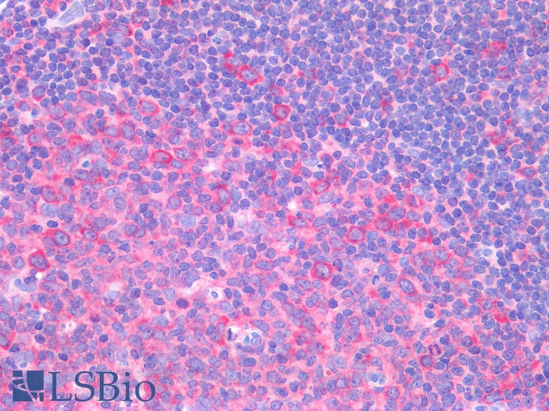 IHC-plus™ Polyclonal Rabbit anti-Human TP53 / p53 Antibody (IHC)