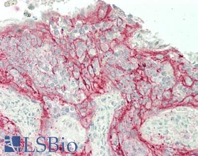 IHC-plus™ Polyclonal Rabbit anti-Human CMTM6 / CKLFSF6 Antibody (IHC, WB)