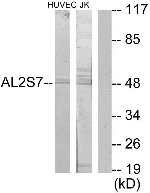 Polyclonal Rabbit anti-Human CDK15 / ALS2CR7 Antibody (WB)