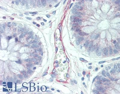 IHC-plus™ Polyclonal Rabbit anti-Human MEP1A / Meprin Alpha Antibody (aa149-175, IHC, WB)