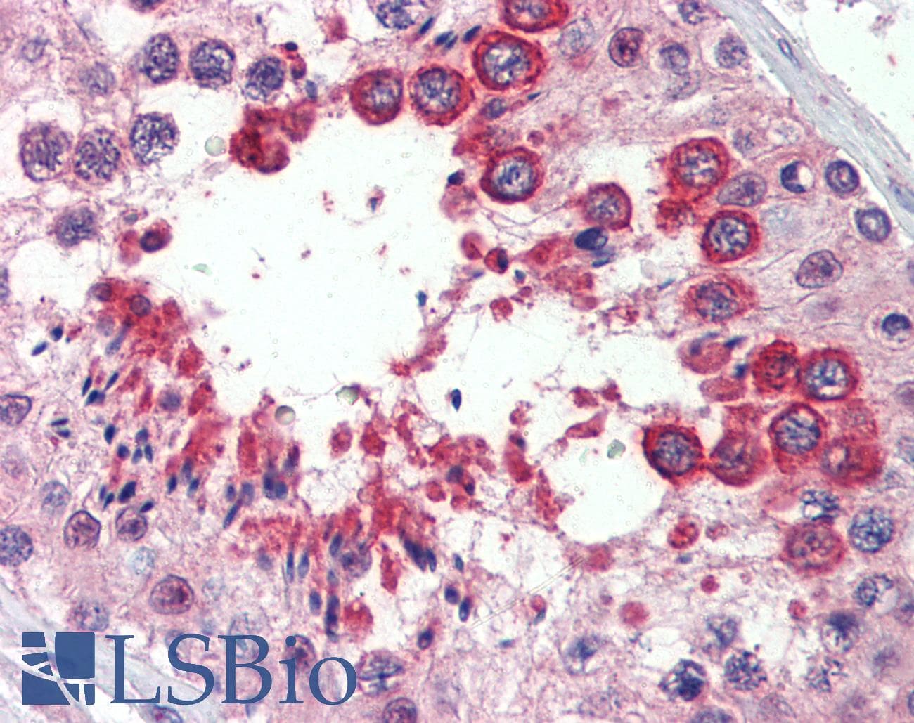 IHC-plus™ RTN4 / Nogo Antibody (aa501-515)