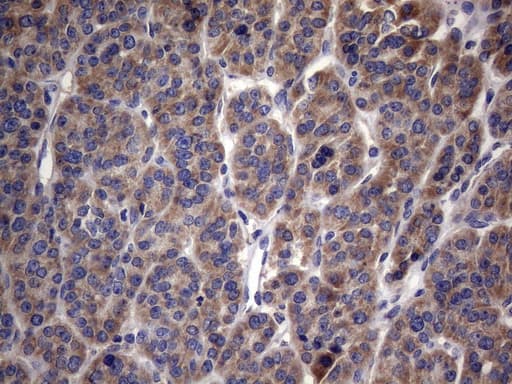 Monoclonal Mouse anti-Human MRPL42 / MRPS32 Antibody (clone OTI1A4, IHC, WB)
