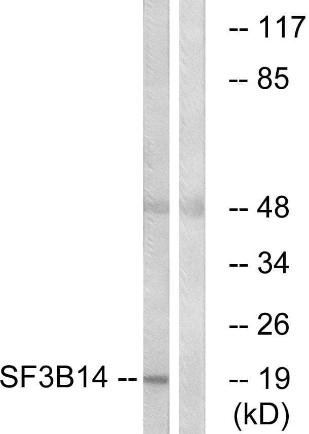 SF3B6 / SF3B14 Antibody