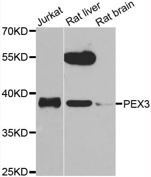 Polyclonal Rabbit anti-Human PEX3 Antibody (IHC, WB)