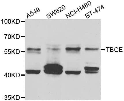 Polyclonal Rabbit anti-Human TCBE / KCS / HRD Antibody (IHC, WB)