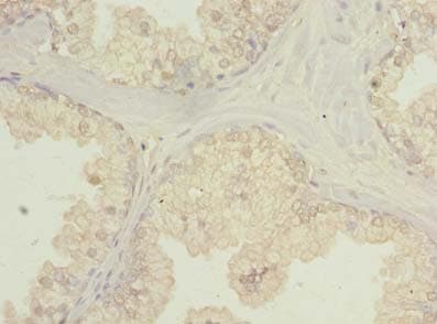 Polyclonal Rabbit anti-Human C20orf195 Antibody (IHC)