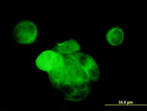 IHC-plus™ Monoclonal Mouse anti-Human MAPK13 / p38delta Antibody (clone 2D8, IHC, IF, WB)