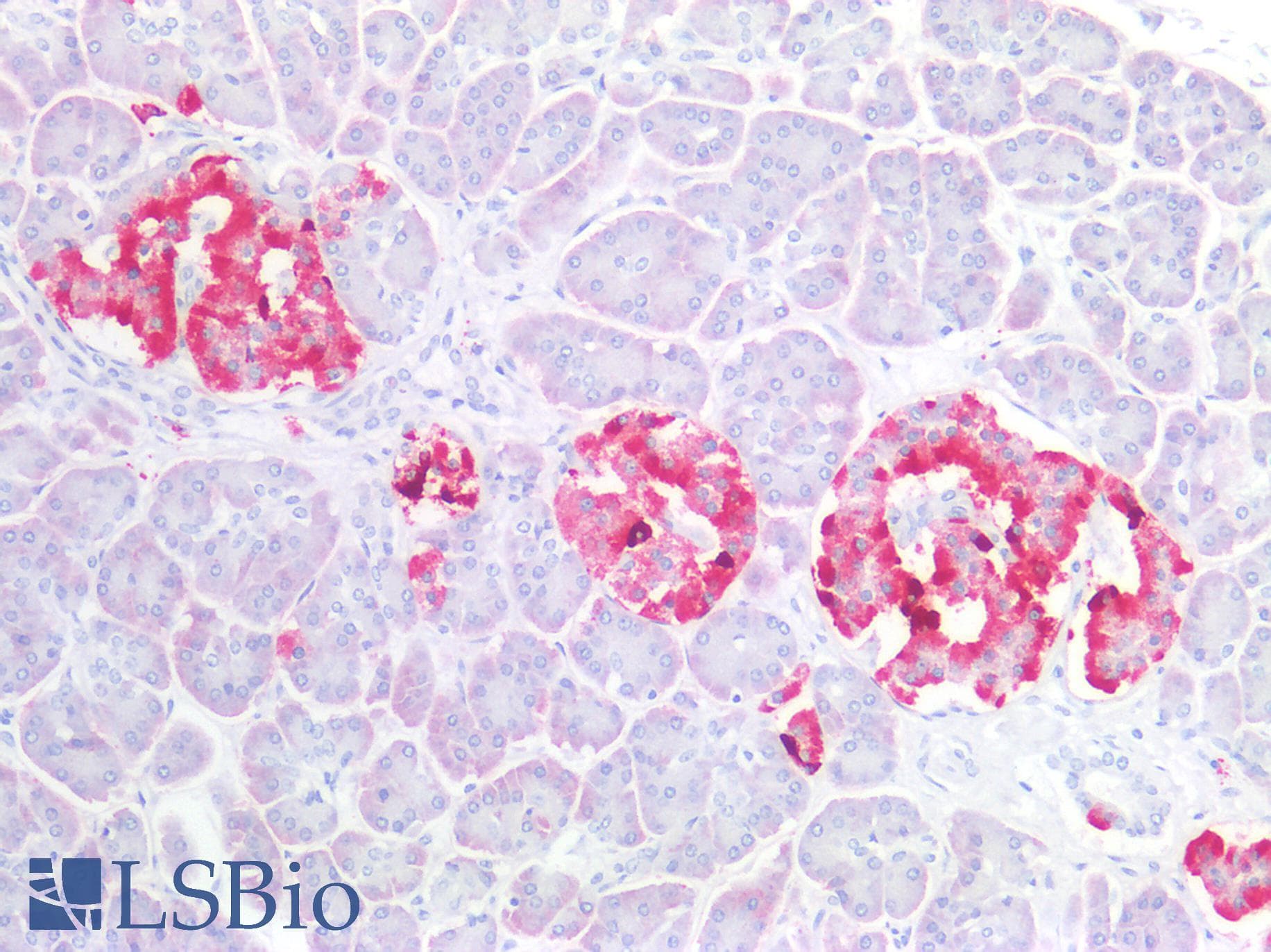 PathPlus™ CHGA / Chromogranin A Antibody