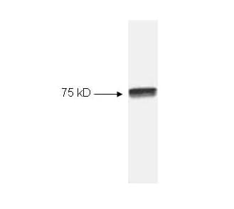 RELA / NFKB p65 Antibody (C-Terminus)