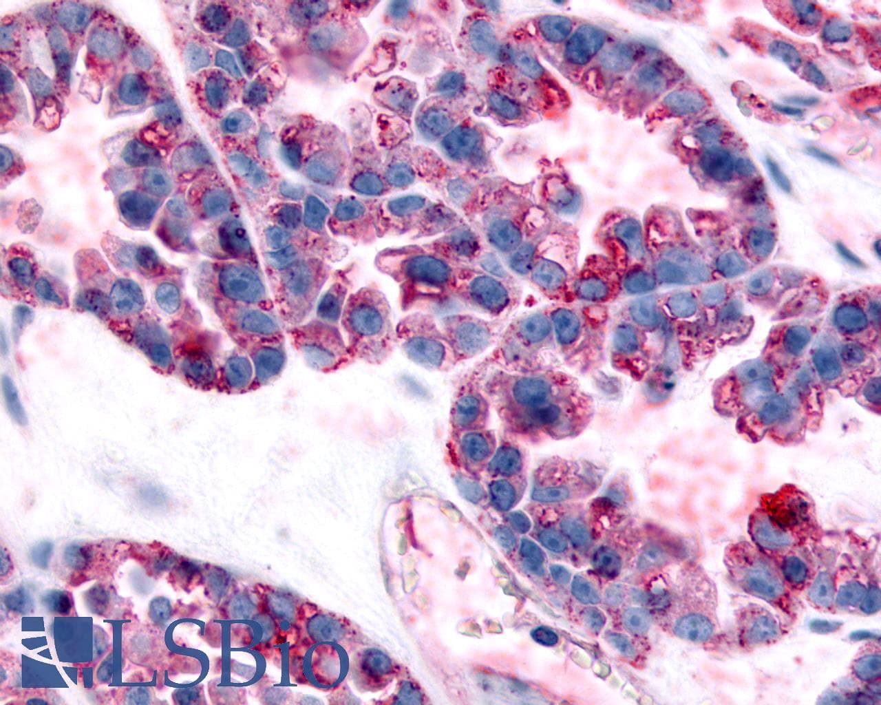 PathPlus™ Polyclonal Rabbit anti-Human GPR32 Antibody (Extracellular Domain, IHC)