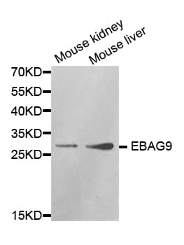 Polyclonal Rabbit anti-Human EBAG9 / RCAS1 Antibody (IHC, WB)