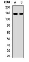SLC4A2 / AE2 Antibody