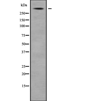 Polyclonal Rabbit anti-Human USP24 Antibody (WB)