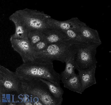 HDEL Tetrapeptide Antibody (clone 2E7)