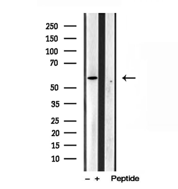 TCTN1 Antibody