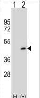 PRMT6 Antibody (aa19-48)