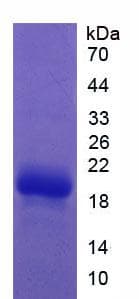 Rat F2 / Prothrombin / Thrombin Protein (Recombinant His, N-Terminal)