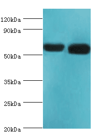 Polyclonal Rabbit anti-Human RALDH2 / ALDH1A2 Antibody (aa1-180, WB)