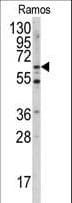 MEN1 / Menin Antibody (Ser128)
