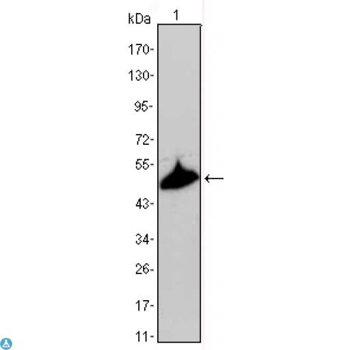 KRT15 / CK15 / Cytokeratin 15 Antibody