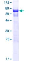 Human BOD1L1 / BOD1L Protein (Recombinant GST)