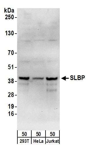 CCAR2 / KIAA1967 Antibody (aa873-923)