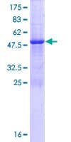 Human TMED5 Protein (Recombinant GST)