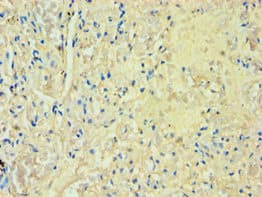Polyclonal Rabbit anti-Human M-PST / STM Antibody (aa1-295, IHC, WB)
