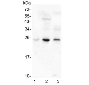 GCL / Grancalcin Antibody