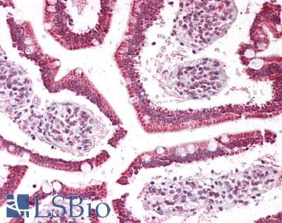 IHC-plus™ Polyclonal Goat anti-Human PLA2G2A / SPLA2 Antibody (IHC, WB)