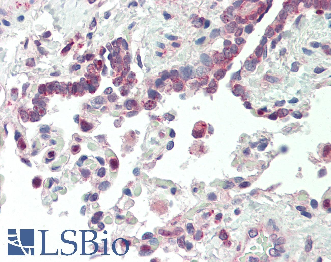 Polyclonal Rabbit anti-Human VARS / ValRS Antibody (aa576-625, IHC, WB)