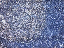 LCMT1 Antibody (clone OTI 1G5)
