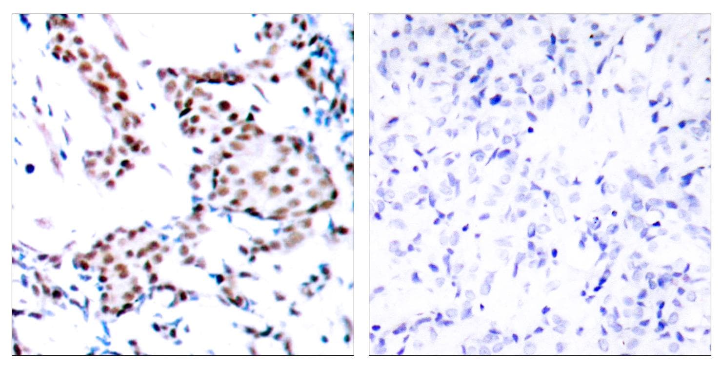 JUN / c-Jun Antibody (p170)