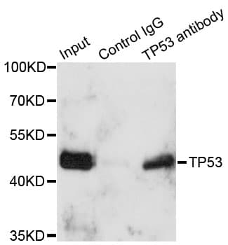 TP53 / p53 Antibody