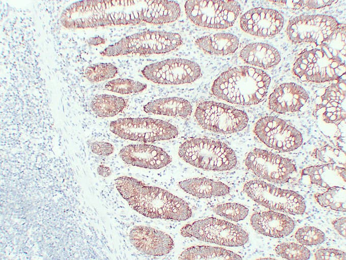EPCAM Antibody (clone ABT-EPCAM)
