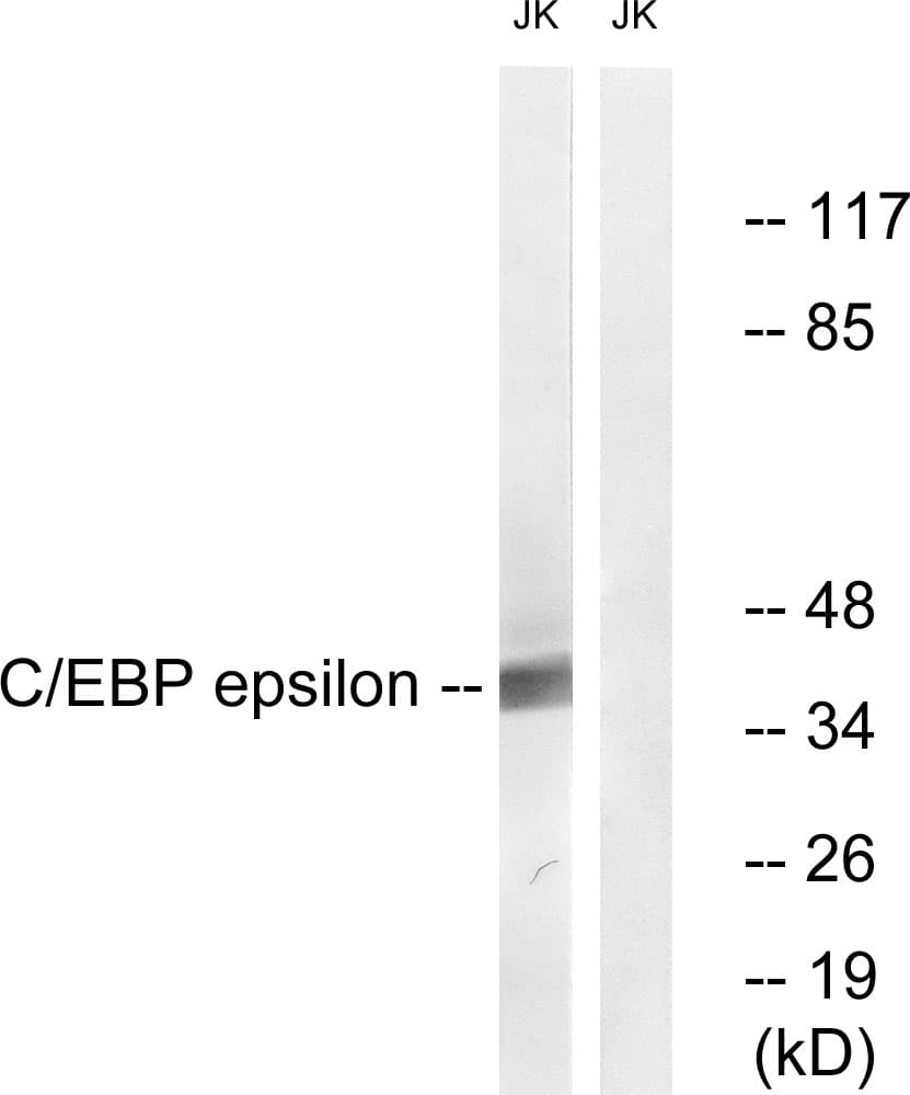 Polyclonal Rabbit anti-Human C/EBP Epsilon / CEBPE Antibody (aa40-89, IHC, IF, WB)