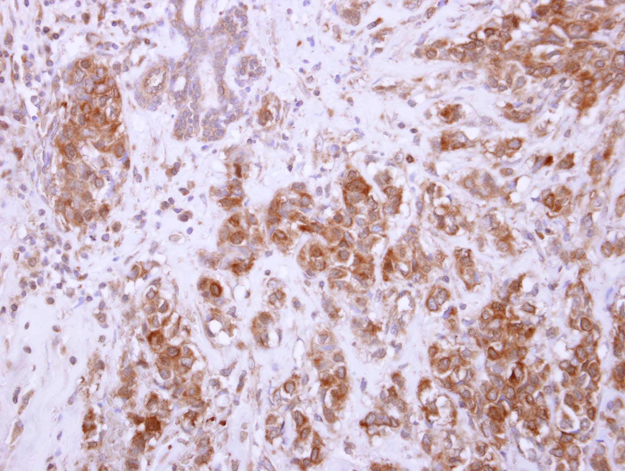 Polyclonal Rabbit anti-Human Chondroadherin / CHAD Antibody (IHC, WB)