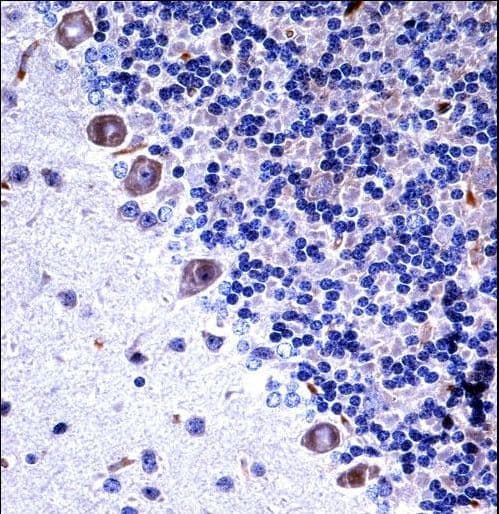 CSF1R / CD115 / FMS Antibody (aa895-923)