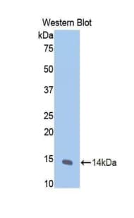 NPPA / ANP Antibody (aa25-122)