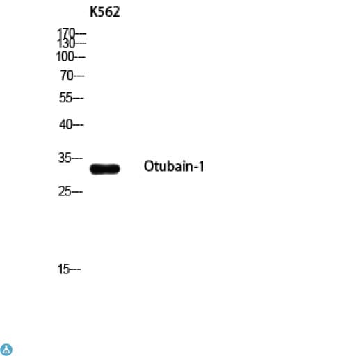 OTUB1 / OTU1 Antibody
