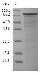 Oryza sativa Os11g0523700 Protein (Recombinant 6His-SUMO, N-terminus)