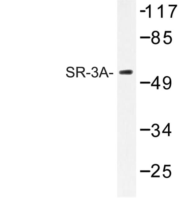 HTR3A / 5-HT3A Receptor Antibody (Trp190)