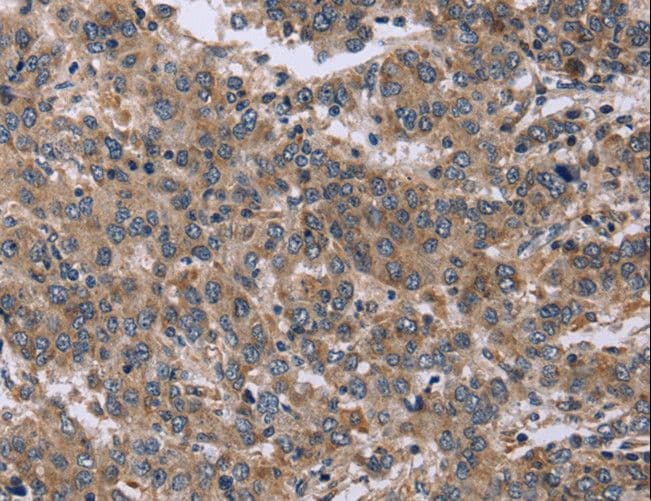 Endothelin 3 / EDN3 Antibody